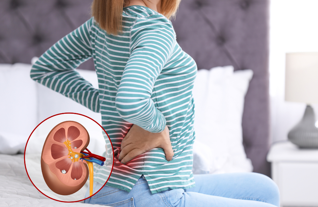 The kidneys are bean-like organs located in your lower back on either side of your spine. 