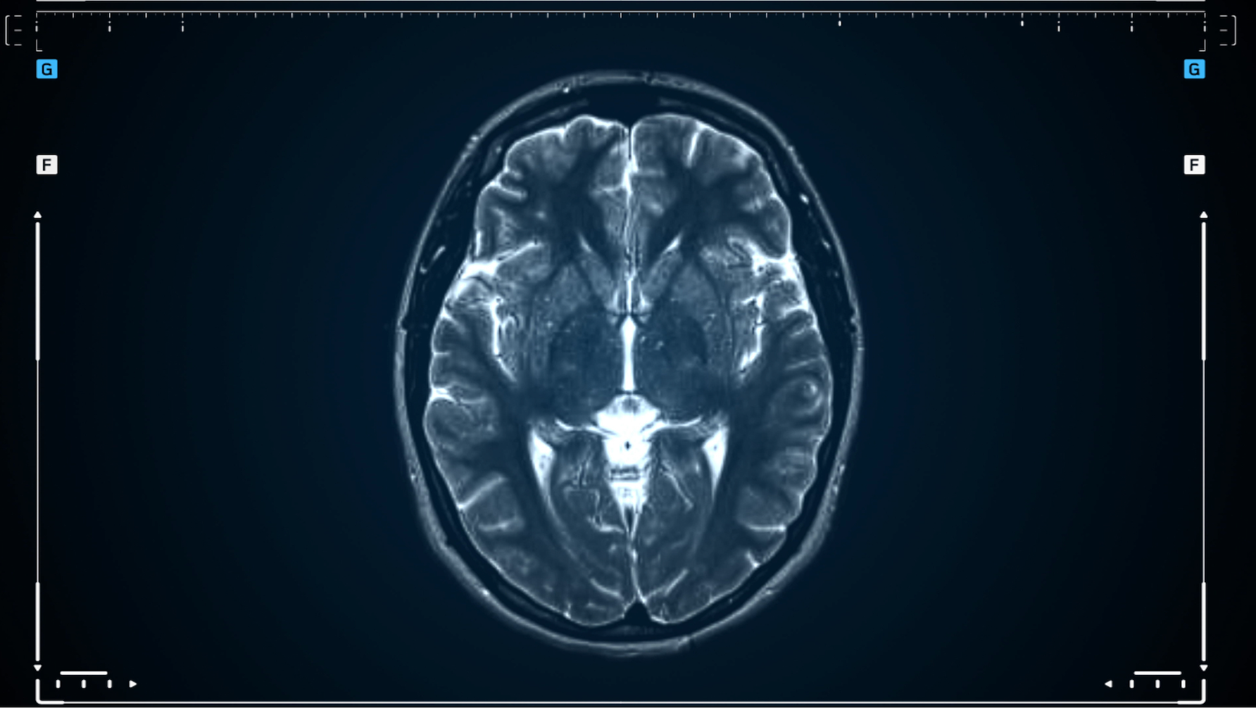 We don't need to soley rely on artificial intelligence if we concentrate on improving brain health.