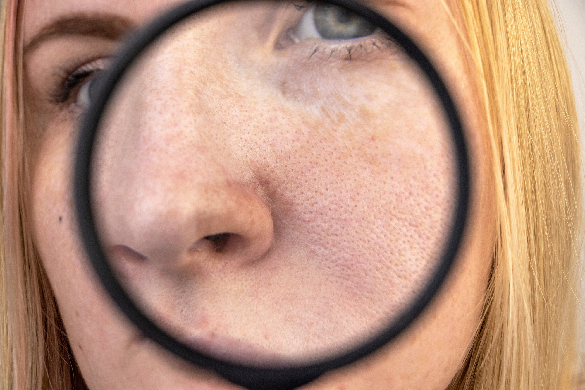 Fulvic acid has been proven to imporve symptoms of acne and scars.