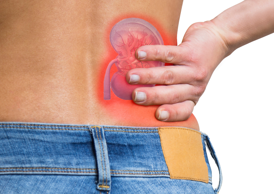 Chronic kidney disease is a progressive disease and can gradually cause deterioation in your kidneys.